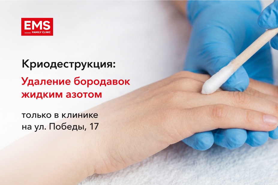 Новая услуга в клинике на ул. Победы, 17 - криодеструкция
