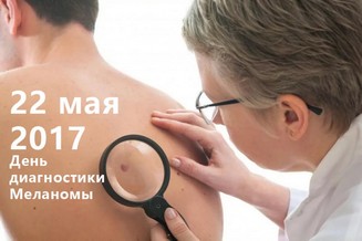 Дерматологи EMS провели бесплатные консультации в День диагностики меланомы