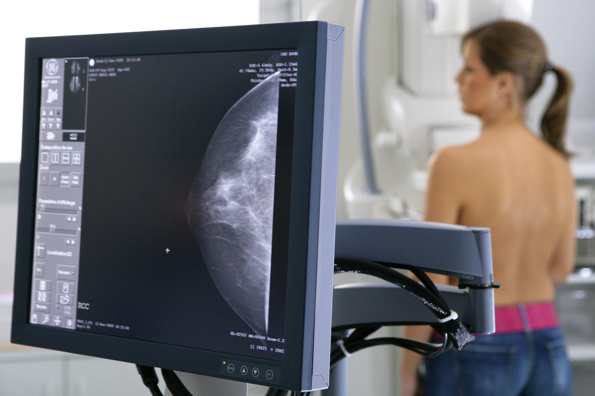 В новой клинике на Энгельса маммография за 990 рублей до 31 октября